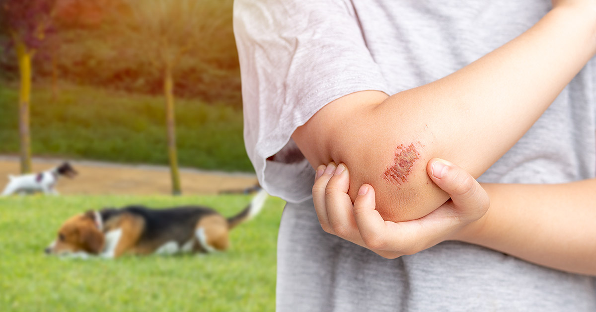 child injured by dog child injured by dog